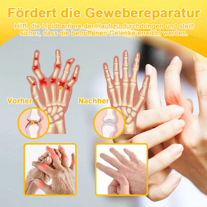 XRLXRL® Bienengift Schmerzstillende Knochenheilungscreme ✨LETZTER TAG 80 % RABATT