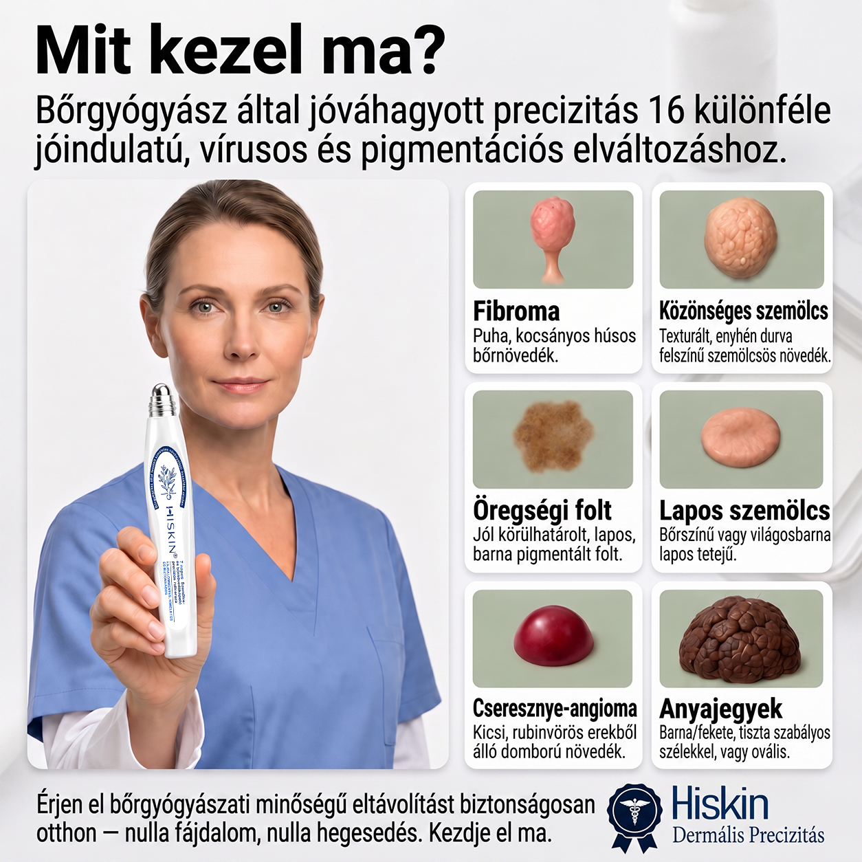 🎁🎁🎁HISKIN® Már csak 5 doboz maradt! Élvezd a további 30% kedvezményt! Távolítsd el a szemölcsöket, javítsd ki a bőrhibákat, és nyerd vissza a tiszta, sima bőrt! Ne hagyd ki ezt a lehetőséget, ez az ajánlat jövőre már nem érvényes.