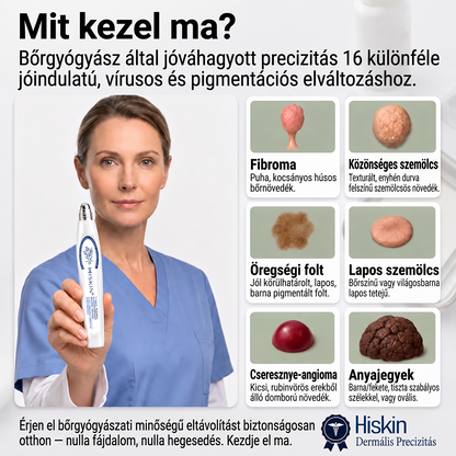 🎁🎁🎁HISKIN® Már csak 5 doboz maradt! Élvezd a további 30% kedvezményt! Távolítsd el a szemölcsöket, javítsd ki a bőrhibákat, és nyerd vissza a tiszta, sima bőrt! Ne hagyd ki ezt a lehetőséget, ez az ajánlat jövőre már nem érvényes.