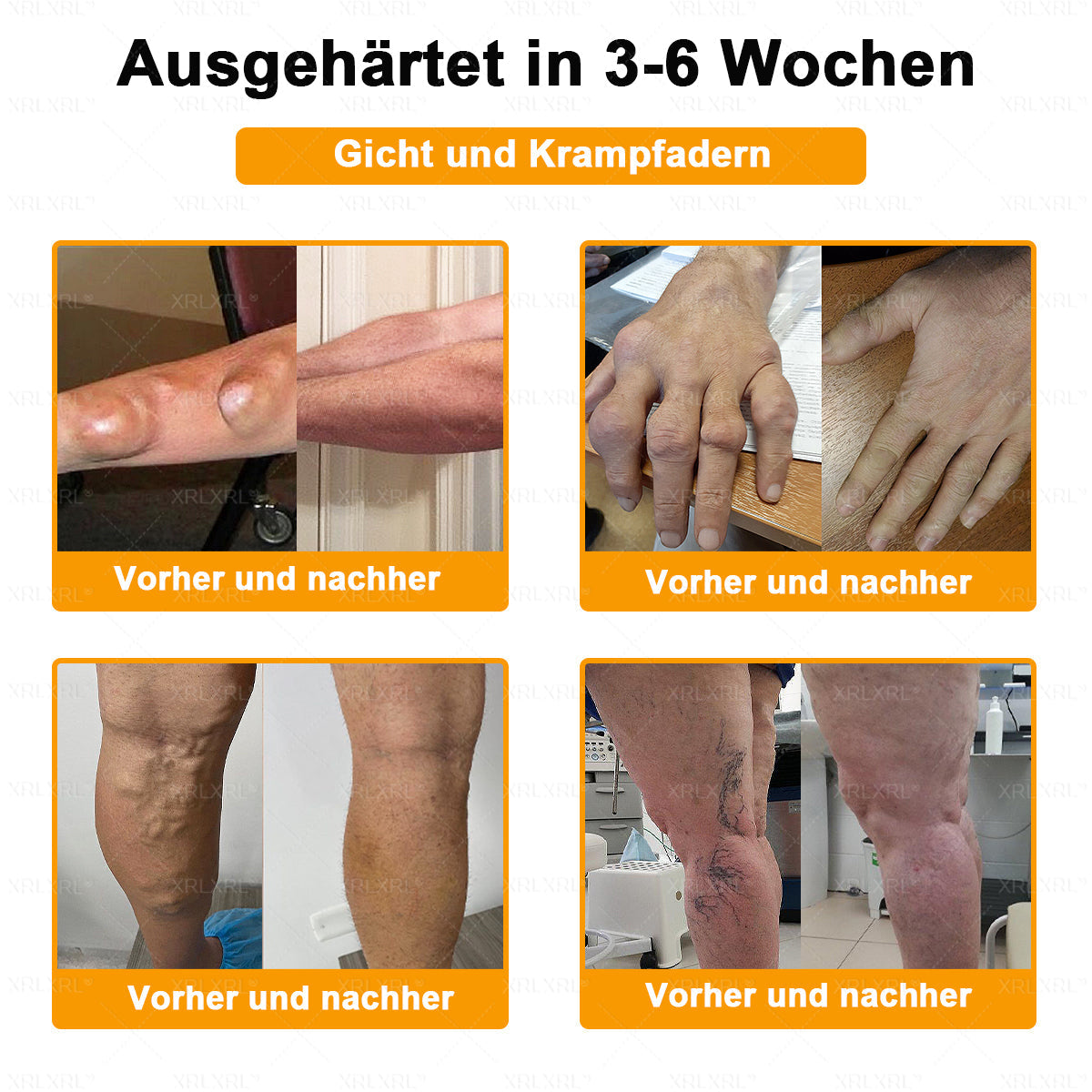 XRLXRL® Bienengift Schmerzstillende Knochenheilungscreme ✨LETZTER TAG 80 % RABATT