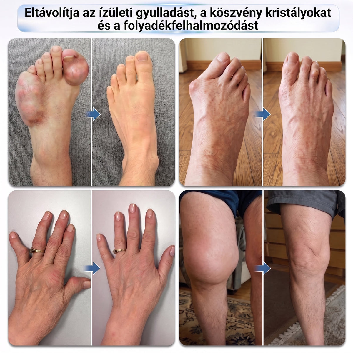 𝐎𝐫𝐯𝐨𝐬𝐢 𝐬𝐳𝐚𝐤𝐞́𝐫𝐭𝐨̋𝐤 𝐚́𝐥𝐭𝐚𝐥 𝐤𝐢𝐟𝐞𝐣𝐥𝐞𝐬𝐳𝐭𝐯𝐞💚 | 𝑿𝑹𝑳𝑿𝑹𝑳® 0,05 mm-es mikrotűs csont- és ízületregeneráló roll-on