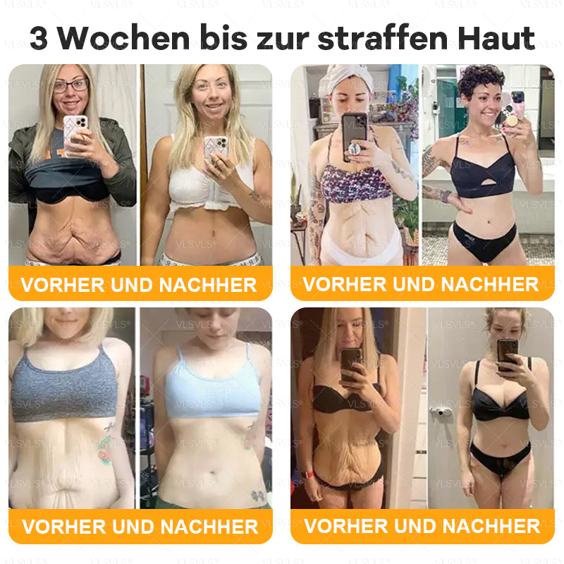 Hergestellt und versendet aus Deutschland  🌸VLSVLS® Bienengift Hautregenerationscreme 🔥 LETZTER TAG 80 % RABATT