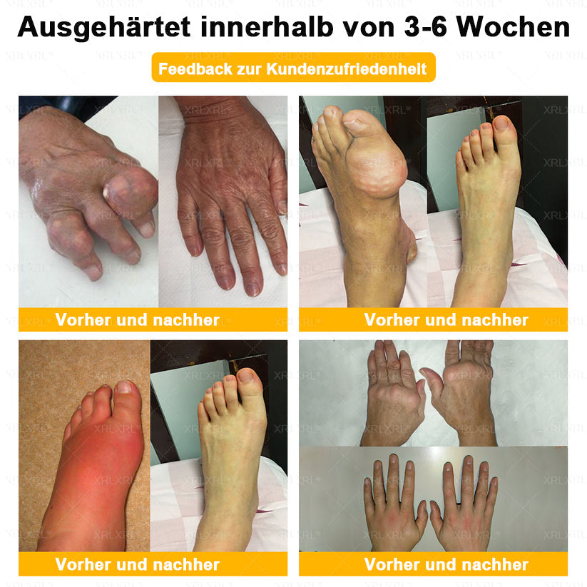 XRLXRL® Bienengift Schmerzstillende Knochenheilungscreme ✨LETZTER TAG 80 % RABATT