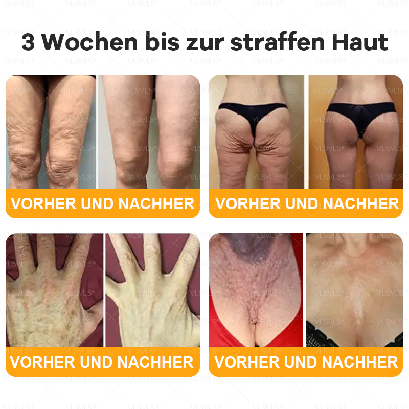 Hergestellt und versendet aus Deutschland  🌸VLSVLS® Bienengift Hautregenerationscreme 🔥 LETZTER TAG 80 % RABATT