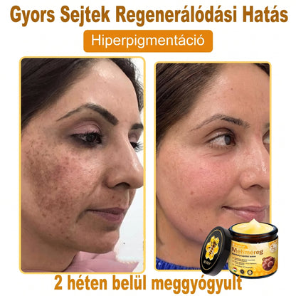 🔹 𝑽𝙇𝙎𝑽𝑳𝑺® Méhméreg Bőr Helyreállító Krém (💖CE Tanúsítvány)👍✅