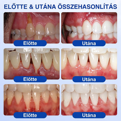 🦷 Dr.Era® GumRevive fogíny- és parodontális regeneráló gél 📬— Célzott ápolás az ínyszélen lepedék, fogszuvasodás, fogágyproblémák, kellemetlen lehelet és meggyengült fogak esetén | Precízen alkalmazható, leöblítést nem igénylő szájápoló formula