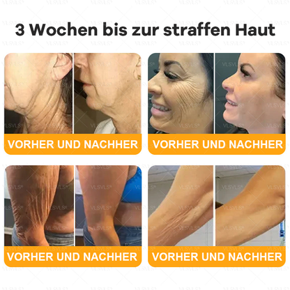 Hergestellt und versendet aus Deutschland  🌸VLSVLS® Bienengift Hautregenerationscreme 🔥 LETZTER TAG 80 % RABATT