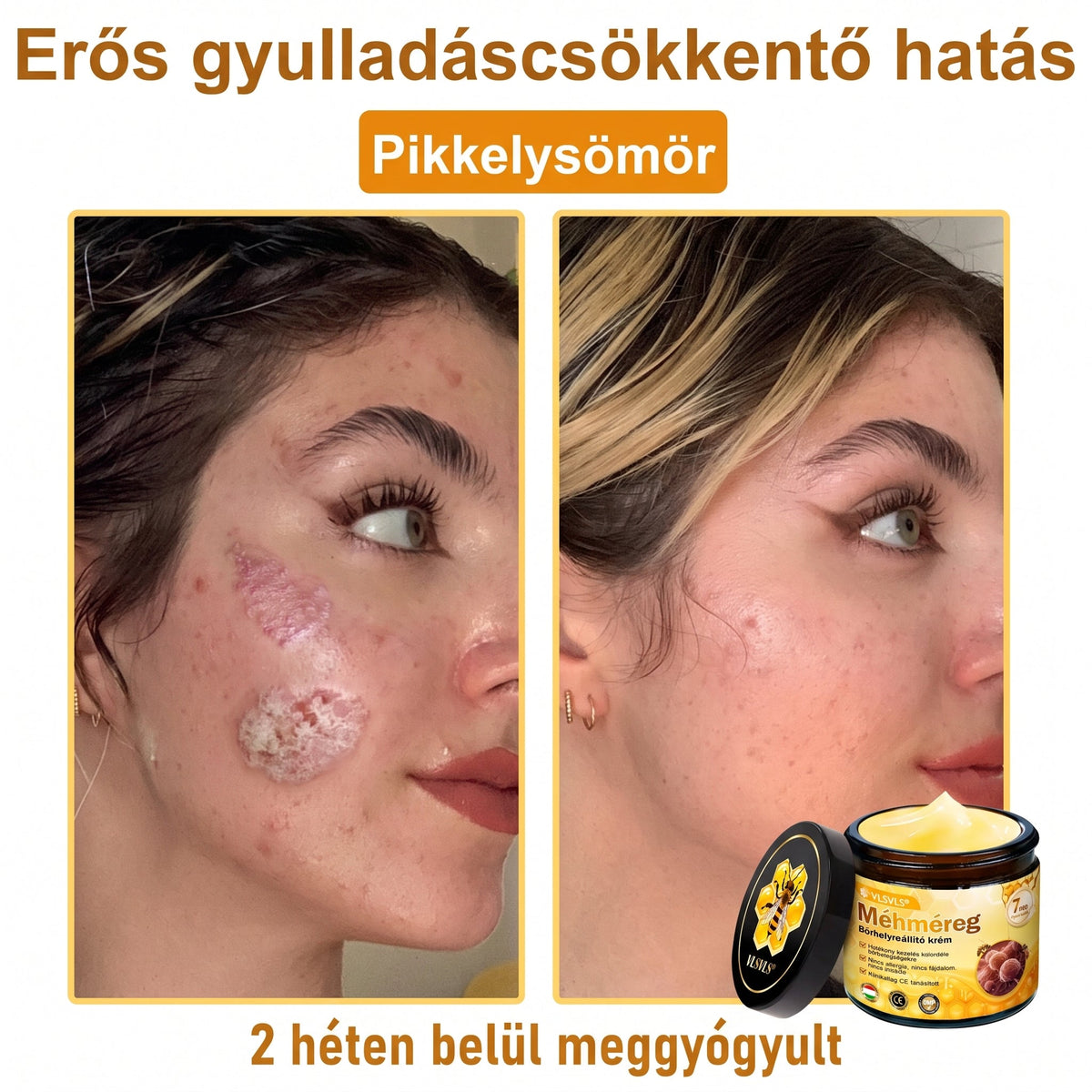 🔹 𝑽𝙇𝙎𝑽𝑳𝑺® Méhméreg Bőr Helyreállító Krém (💖CE Tanúsítvány)👍✅