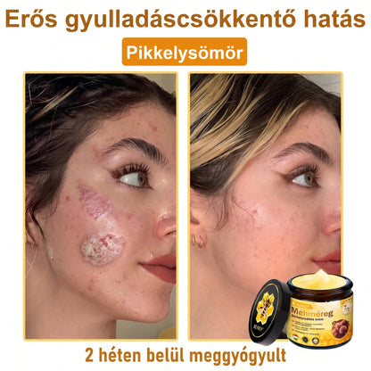 🔹 𝑽𝙇𝙎𝑽𝑳𝑺® Méhméreg Bőr Helyreállító Krém (💖CE Tanúsítvány)👍✅