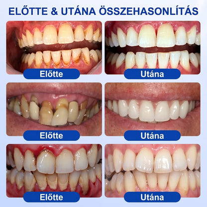 🦷 Dr.Era® GumRevive fogíny- és parodontális regeneráló gél 📬— Célzott ápolás az ínyszélen lepedék, fogszuvasodás, fogágyproblémák, kellemetlen lehelet és meggyengült fogak esetén | Precízen alkalmazható, leöblítést nem igénylő szájápoló formula