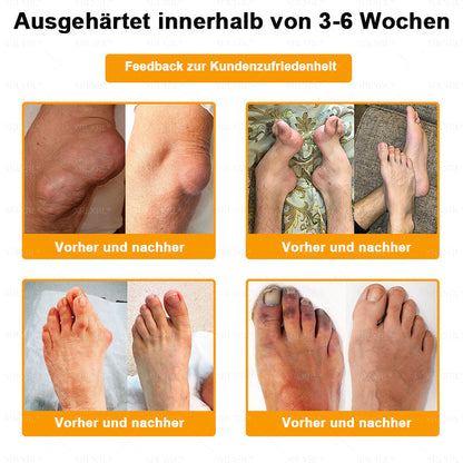 XRLXRL® Bienengift Schmerzstillende Knochenheilungscreme ✨LETZTER TAG 80 % RABATT