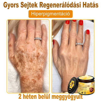 🔹 𝑽𝙇𝙎𝑽𝑳𝑺® Méhméreg Bőr Helyreállító Krém (💖CE Tanúsítvány)👍✅