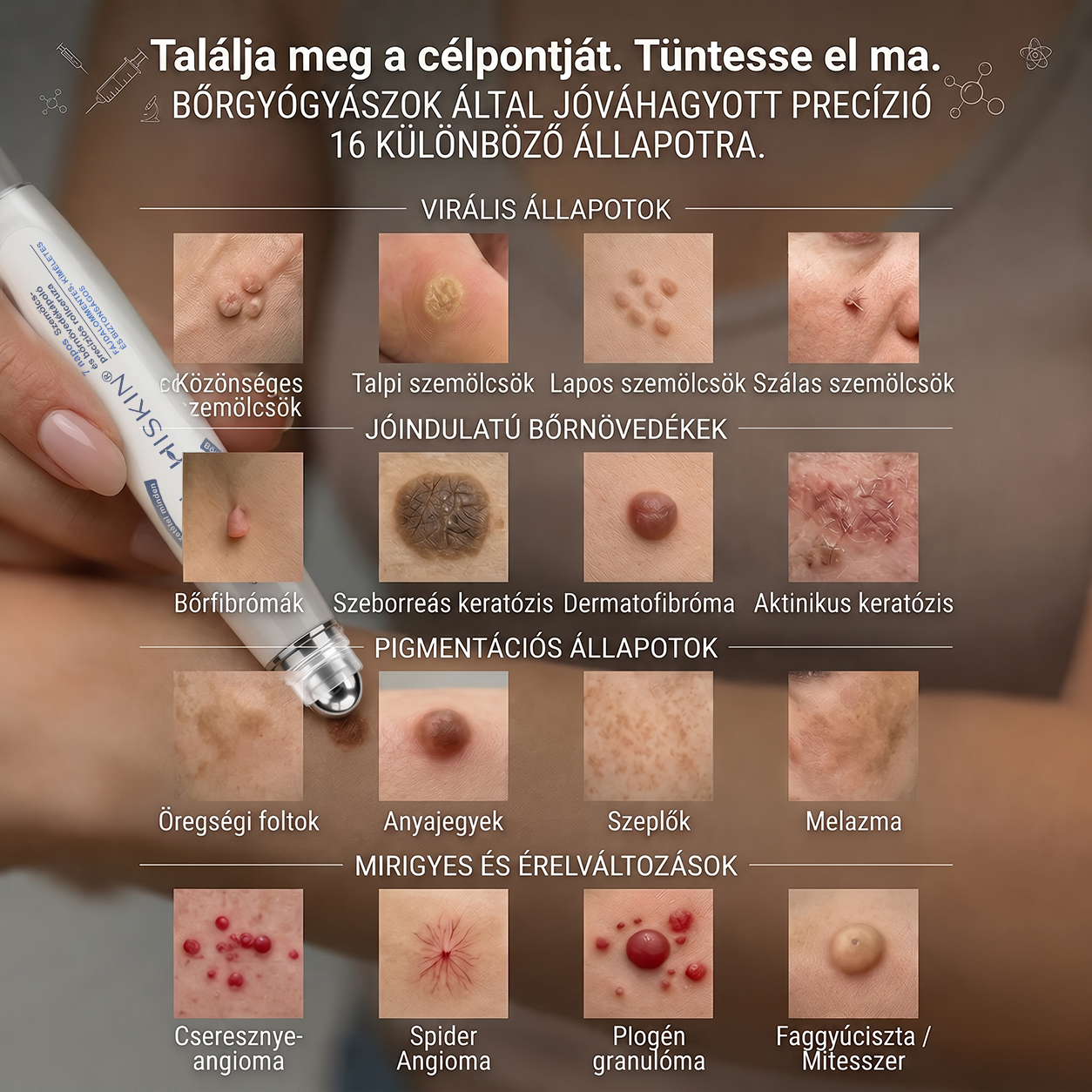 🎁🎁🎁HISKIN® Már csak 5 doboz maradt! Élvezd a további 30% kedvezményt! Távolítsd el a szemölcsöket, javítsd ki a bőrhibákat, és nyerd vissza a tiszta, sima bőrt! Ne hagyd ki ezt a lehetőséget, ez az ajánlat jövőre már nem érvényes.