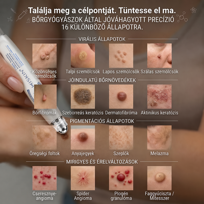 🎁🎁🎁HISKIN® Már csak 5 doboz maradt! Élvezd a további 30% kedvezményt! Távolítsd el a szemölcsöket, javítsd ki a bőrhibákat, és nyerd vissza a tiszta, sima bőrt! Ne hagyd ki ezt a lehetőséget, ez az ajánlat jövőre már nem érvényes.