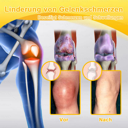 XRLXRL® Bienengift Schmerzstillende Knochenheilungscreme ✨LETZTER TAG 80 % RABATT