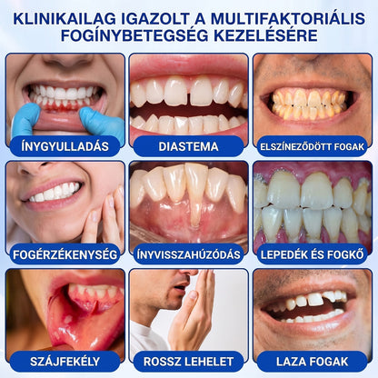 🦷 Dr.Era® GumRevive fogíny- és parodontális regeneráló gél 📬— Célzott ápolás az ínyszélen lepedék, fogszuvasodás, fogágyproblémák, kellemetlen lehelet és meggyengült fogak esetén | Precízen alkalmazható, leöblítést nem igénylő szájápoló formula