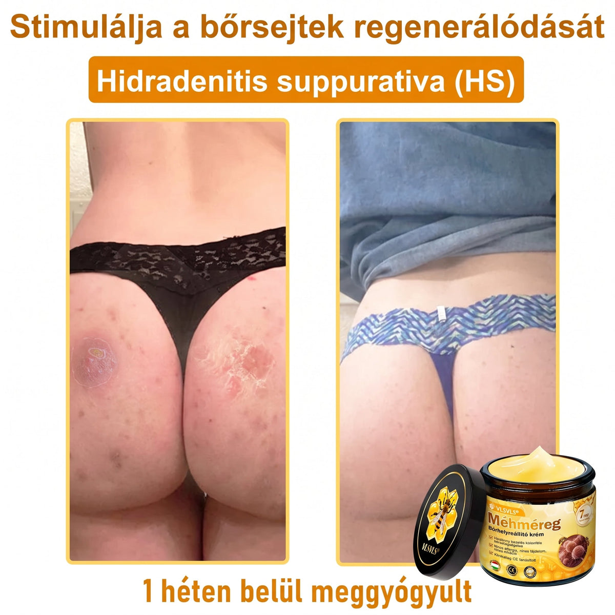 🔹 𝑽𝙇𝙎𝑽𝑳𝑺® Méhméreg Bőr Helyreállító Krém (💖CE Tanúsítvány)👍✅
