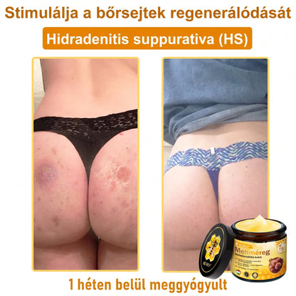 🔹 𝑽𝙇𝙎𝑽𝑳𝑺® Méhméreg Bőr Helyreállító Krém (💖CE Tanúsítvány)👍✅