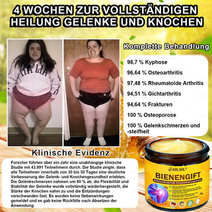 XRLXRL® Bienengift Schmerzstillende Knochenheilungscreme ✨LETZTER TAG 80 % RABATT
