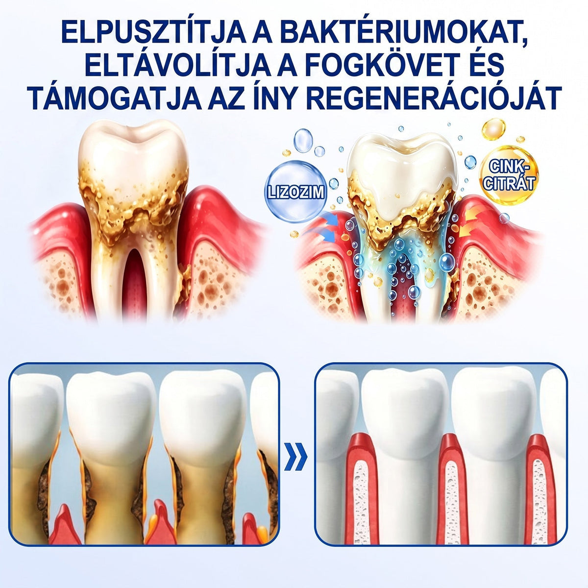 🦷 Dr.Era® GumRevive fogíny- és parodontális regeneráló gél 📬— Célzott ápolás az ínyszélen lepedék, fogszuvasodás, fogágyproblémák, kellemetlen lehelet és meggyengült fogak esetén | Precízen alkalmazható, leöblítést nem igénylő szájápoló formula