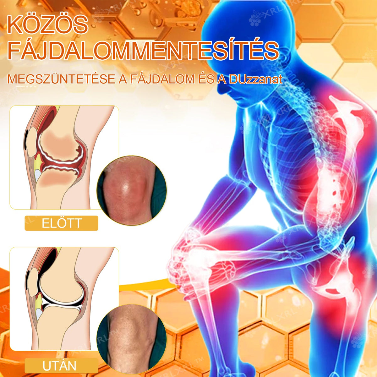 Hivatalos bolt: XRLXRL® Méhméreg Azonnali Ultra Erős Fájdalomcsillapító Krém - (👩‍⚕️🌻Enyhíti a fájdalmat ízületi gyulladás, izomfájdalom, hátfájás, térdek, hát, vállak, csípők, csuklók, kezek esetén)