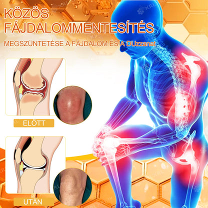 Hivatalos bolt: XRLXRL® Méhméreg Azonnali Ultra Erős Fájdalomcsillapító Krém - (👩‍⚕️🌻Enyhíti a fájdalmat ízületi gyulladás, izomfájdalom, hátfájás, térdek, hát, vállak, csípők, csuklók, kezek esetén)