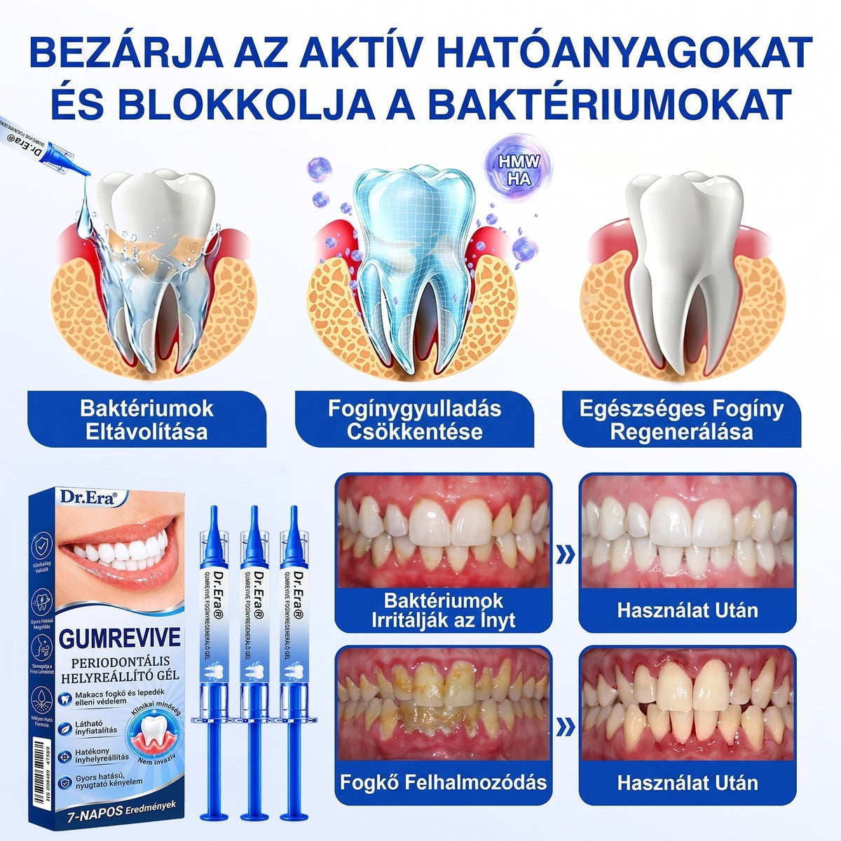 🦷 Dr.Era® GumRevive fogíny- és parodontális regeneráló gél 📬— Célzott ápolás az ínyszélen lepedék, fogszuvasodás, fogágyproblémák, kellemetlen lehelet és meggyengült fogak esetén | Precízen alkalmazható, leöblítést nem igénylő szájápoló formula