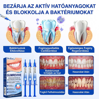 🦷 Dr.Era® GumRevive fogíny- és parodontális regeneráló gél 📬— Célzott ápolás az ínyszélen lepedék, fogszuvasodás, fogágyproblémák, kellemetlen lehelet és meggyengült fogak esetén | Precízen alkalmazható, leöblítést nem igénylő szájápoló formula