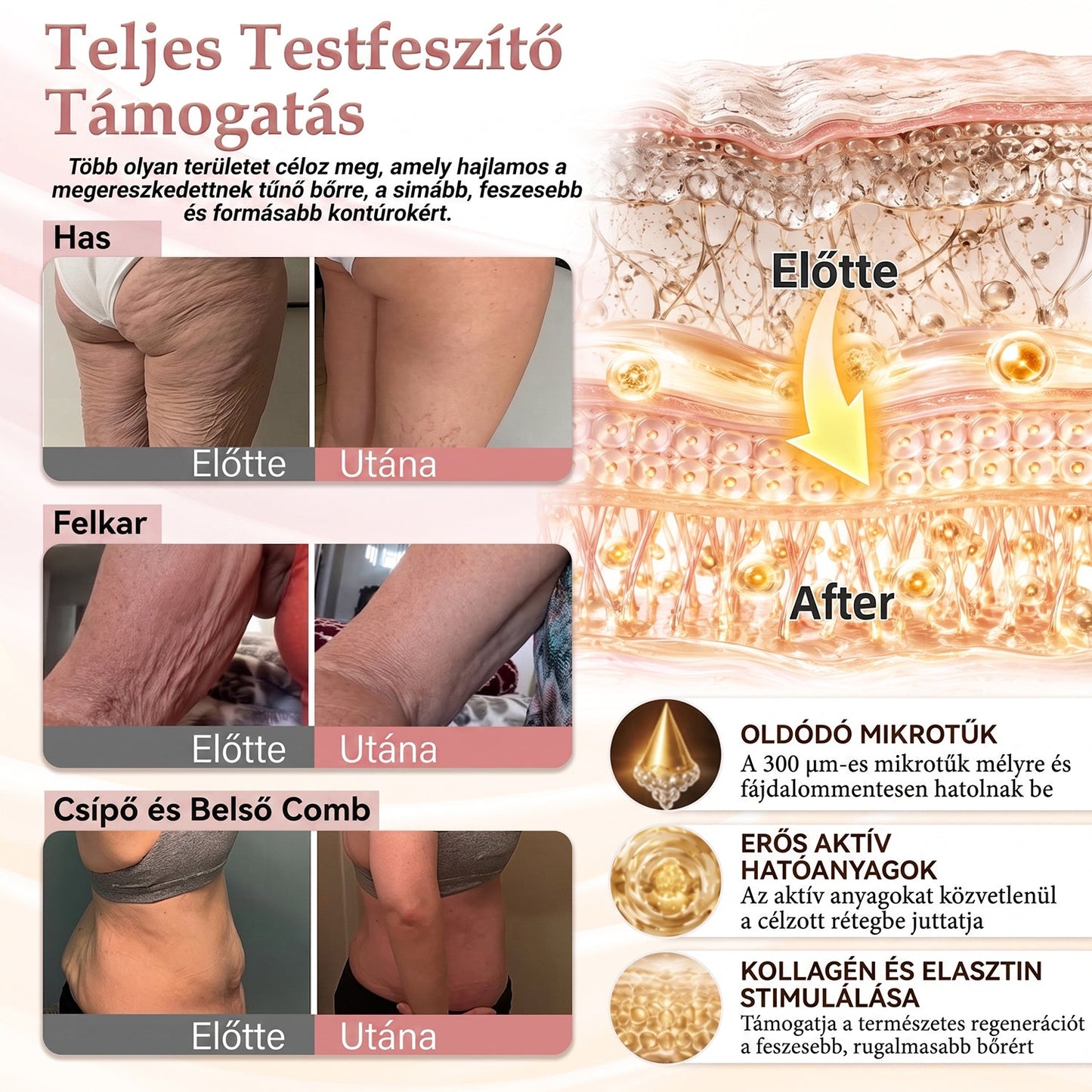🎁🎁🎁HISKIN® Már csak 5 doboz maradt! Most további 30% kedvezmény! Támogasd ízületeid egészségét, csökkentsd a fájdalmat és mozogj újra szabadon!Ha most kihagyod, jövő évig nem lesz újabb lehetőséged