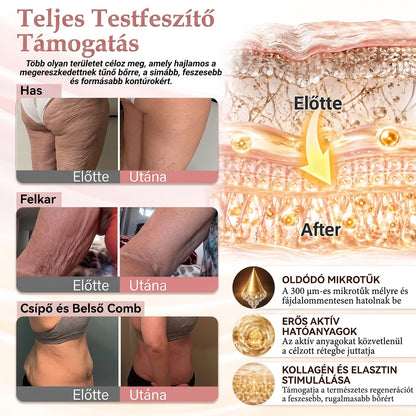 🎁🎁🎁HISKIN® Már csak 5 doboz maradt! Most további 30% kedvezmény! Támogasd ízületeid egészségét, csökkentsd a fájdalmat és mozogj újra szabadon!Ha most kihagyod, jövő évig nem lesz újabb lehetőséged