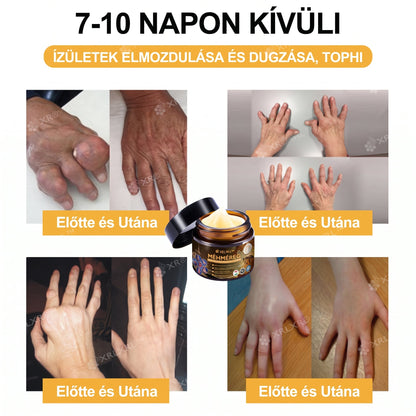 Hivatalos bolt: XRLXRL® Méhméreg Azonnali Ultra Erős Fájdalomcsillapító Krém - (👩‍⚕️🌻Enyhíti a fájdalmat ízületi gyulladás, izomfájdalom, hátfájás, térdek, hát, vállak, csípők, csuklók, kezek esetén)