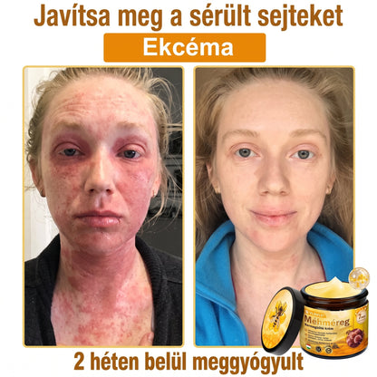 🔹 𝑽𝙇𝙎𝑽𝑳𝑺® Méhméreg Bőr Helyreállító Krém (💖CE Tanúsítvány)👍✅