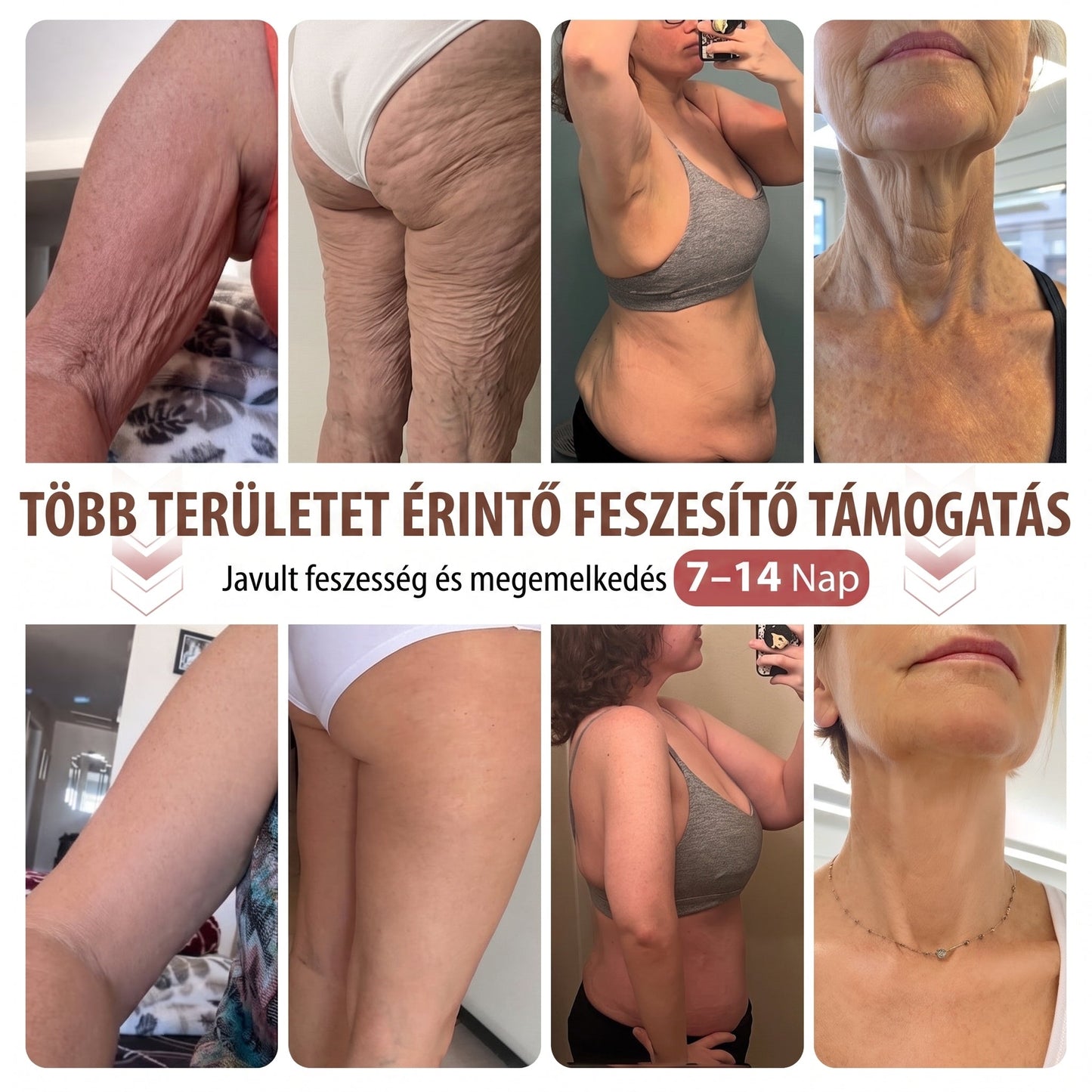 🎁🎁🎁HISKIN® Már csak 5 doboz maradt! Most további 30% kedvezmény! Támogasd ízületeid egészségét, csökkentsd a fájdalmat és mozogj újra szabadon!Ha most kihagyod, jövő évig nem lesz újabb lehetőséged