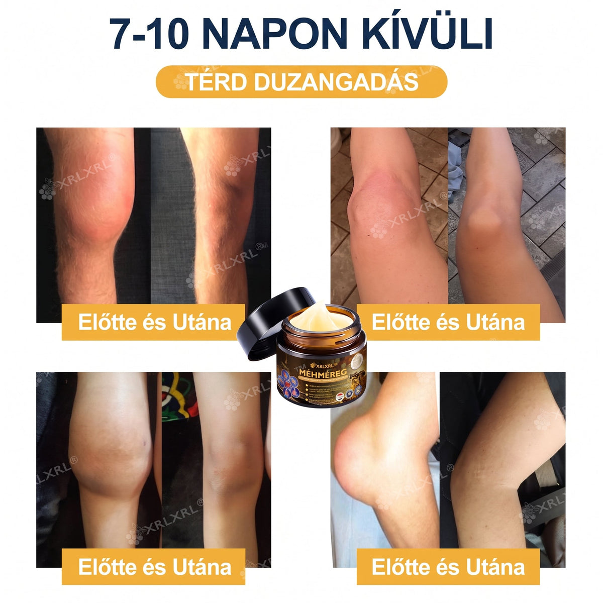 Hivatalos bolt: XRLXRL® Méhméreg Azonnali Ultra Erős Fájdalomcsillapító Krém - (👩‍⚕️🌻Enyhíti a fájdalmat ízületi gyulladás, izomfájdalom, hátfájás, térdek, hát, vállak, csípők, csuklók, kezek esetén)