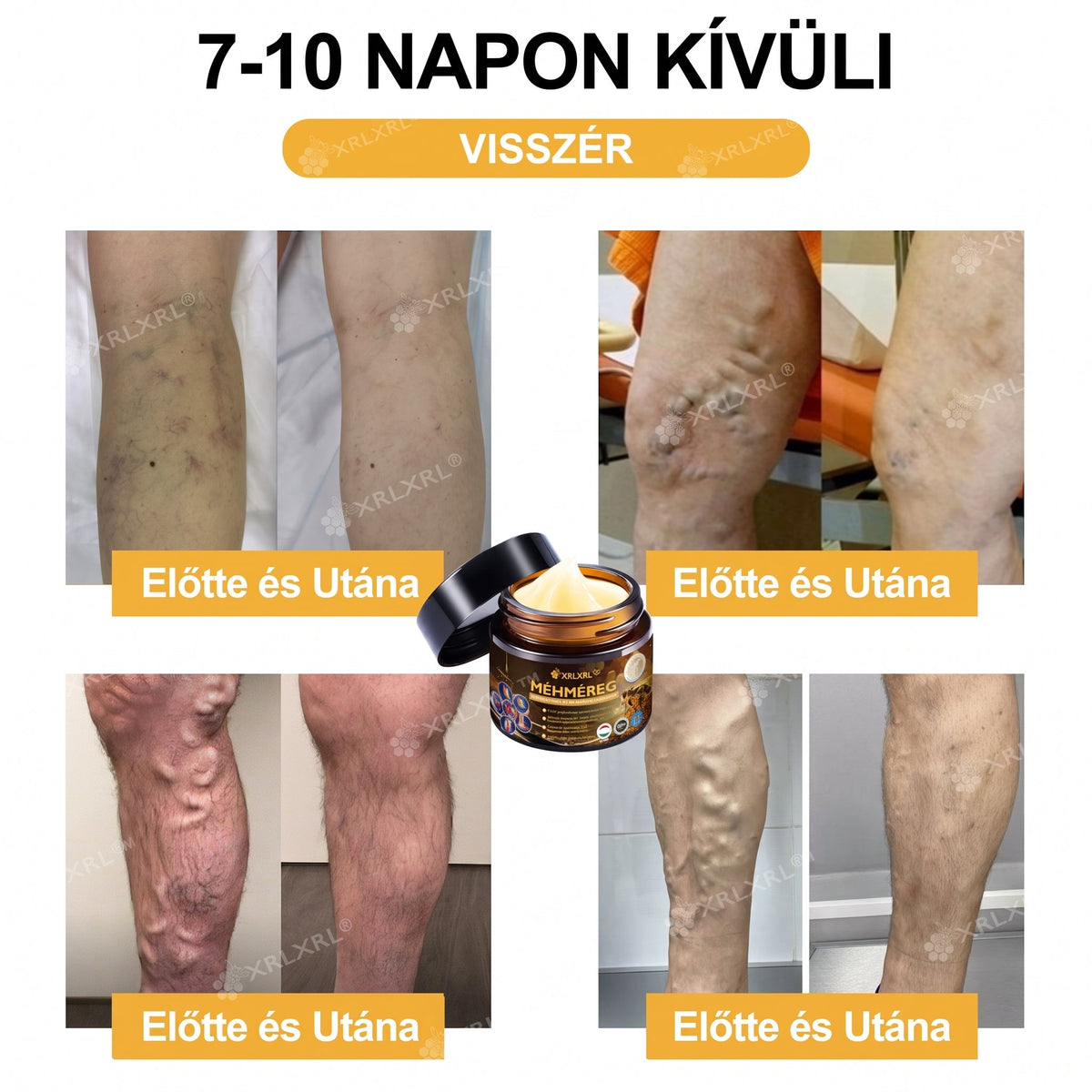 Hivatalos bolt: XRLXRL® Méhméreg Azonnali Ultra Erős Fájdalomcsillapító Krém - (👩‍⚕️🌻Enyhíti a fájdalmat ízületi gyulladás, izomfájdalom, hátfájás, térdek, hát, vállak, csípők, csuklók, kezek esetén)
