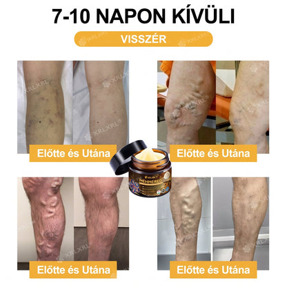Hivatalos bolt: XRLXRL® Méhméreg Azonnali Ultra Erős Fájdalomcsillapító Krém - (👩‍⚕️🌻Enyhíti a fájdalmat ízületi gyulladás, izomfájdalom, hátfájás, térdek, hát, vállak, csípők, csuklók, kezek esetén)